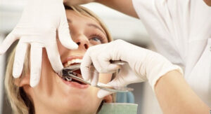 Teeth Removal