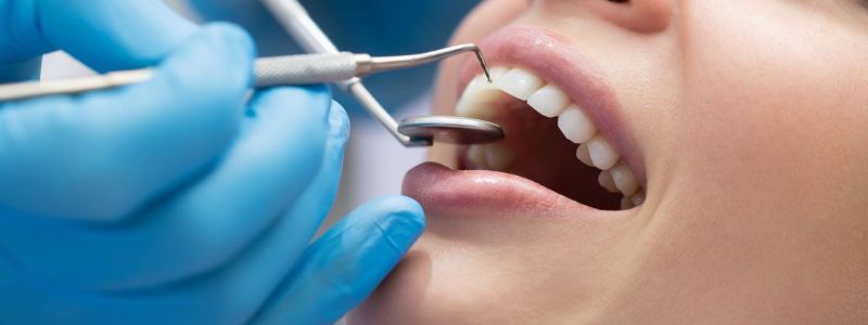 wisdom teeth removal cost