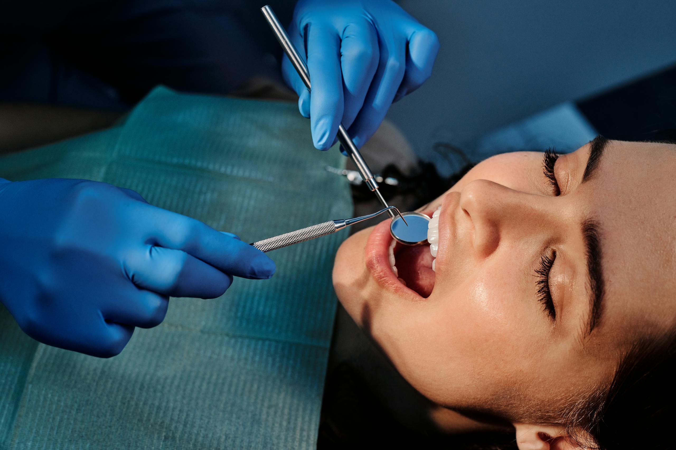 wisdom teeth removal - wisdom teeth removal sydney professionals - sydney