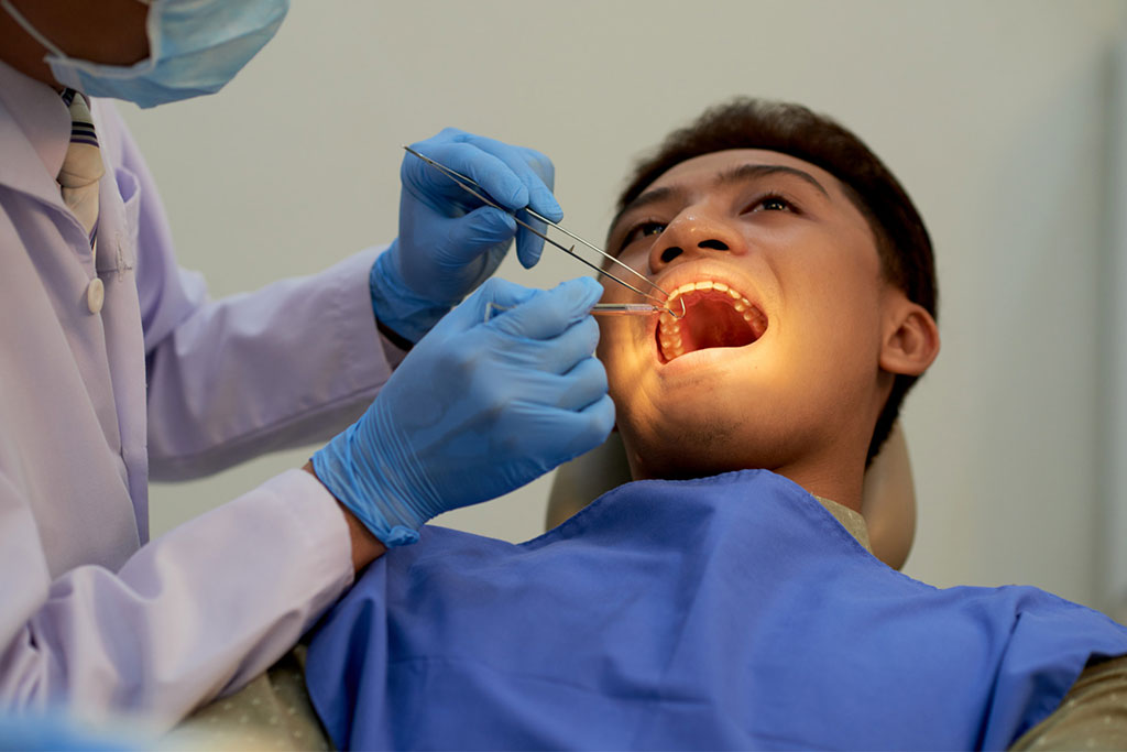 Optimal age for wisdom tooth removal in Sydney for faster recovery