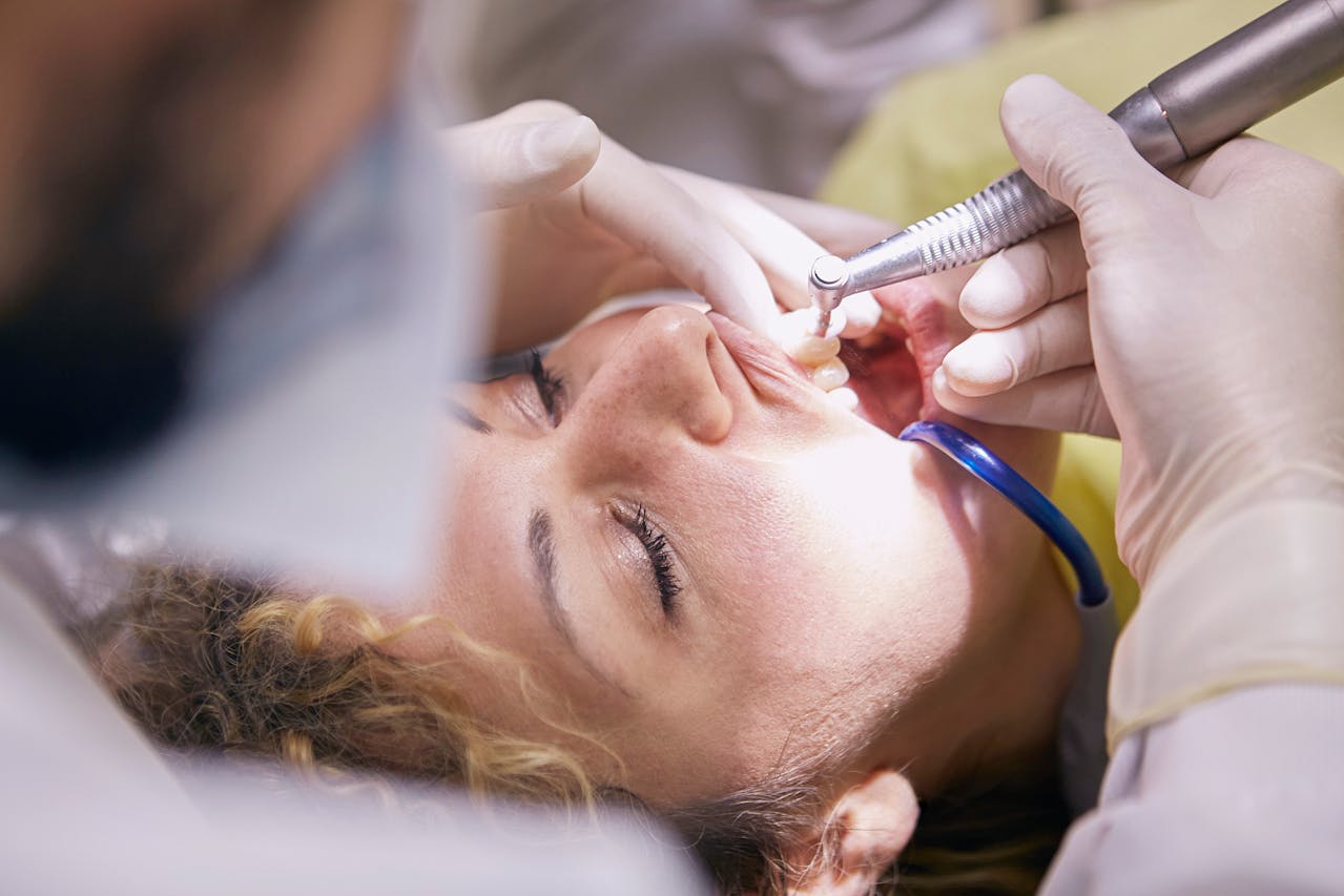 Wisdom Teeth Extraction Procedure at the Dentist